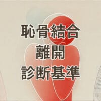 恥骨結合離開の診断基準を示すイラスト