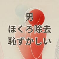 男 ほくろ 除去 恥ずかしい を解説するアイキャッチ画像