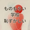 ものもらい 学校 恥ずかしい 学生の目元イメージ