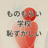 ものもらい 学校 恥ずかしい 学生の目元イメージ