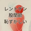 レントゲン 股関節 恥ずかしいと感じる撮影時の不安と対策