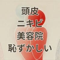 頭皮 ニキビ 美容 院 恥ずかしい時の対処法と施術可否