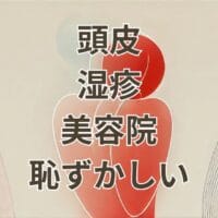 頭皮湿疹で美容院に行くのが恥ずかしい人向けの解説画像
