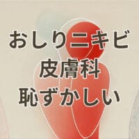 おしりニキビを皮膚科で診てもらうのが恥ずかしいと悩む人向け説明イメージ